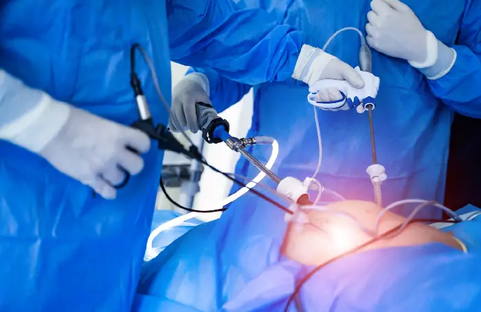 Histerectomía abierta y laparoscópica